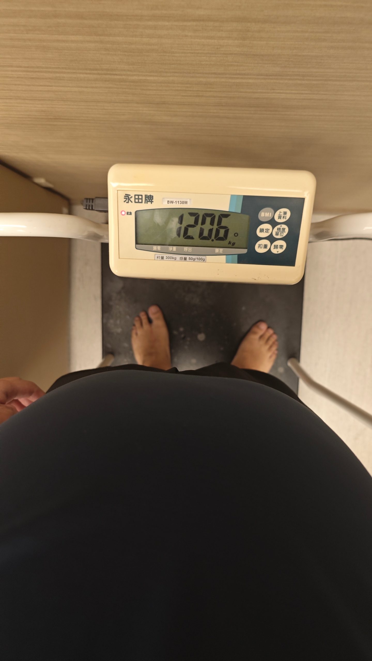 【輝哥縮胃曠腸心得】46萬縮胃手術經驗分享(開刀費用、中國醫病房環境、保險理賠) - 縮胃曠腸, 縮胃手術, 輝哥縮胃 - 敗家達人推薦